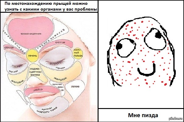 Все о прыщах книга Все о прыщах книга