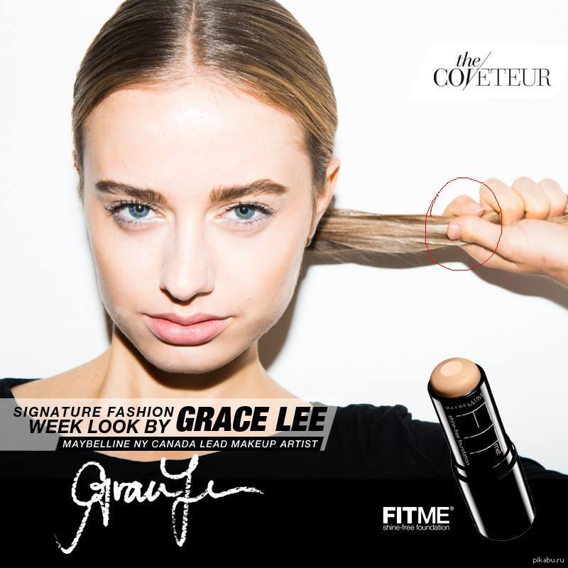 Брахидактилия фото